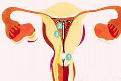 子宫内膜单纯性增生