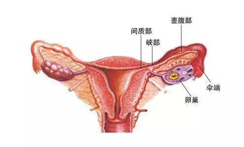 女性双侧输卵管堵塞