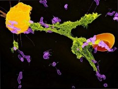 免疫细胞像蜘蛛一样布网，协同合作捕食细菌
