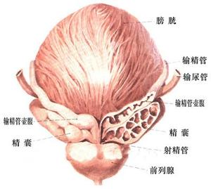 淋菌性前列腺炎