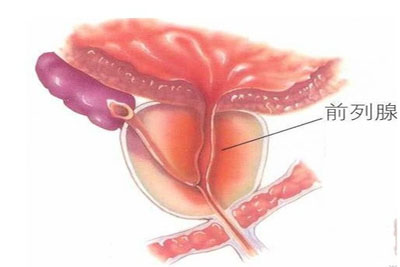 前列腺炎吃什么药