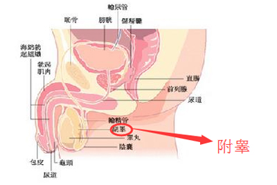 慢性附睾炎