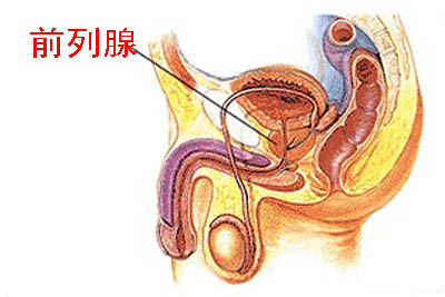 前列腺炎