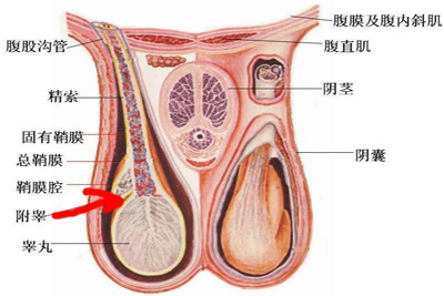 附睾炎