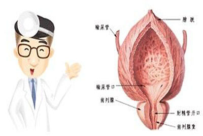 前列腺炎