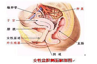 盆腔粘连