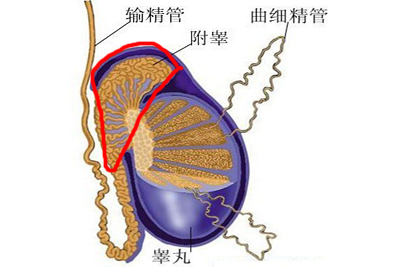 慢性附睾炎