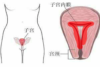 子宫内壁增厚