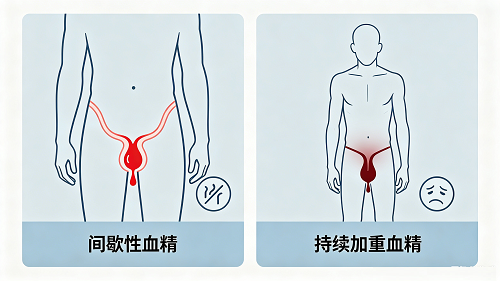 40 岁以上出现血精，是精囊炎还是需要排查前列腺癌