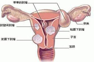 绝经期子宫内膜增厚咋办