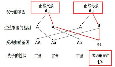 苯丙酮尿症