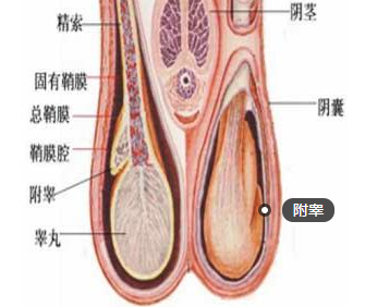 附睾炎硬结