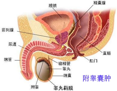 附睾头囊肿