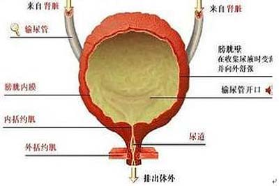 膀胱炎