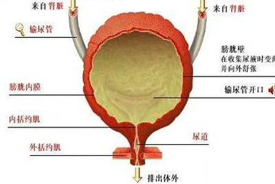 滤泡性膀胱炎