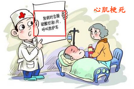心肌梗死