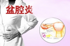 妇炎丸3个疗程治愈支原体盆腔炎