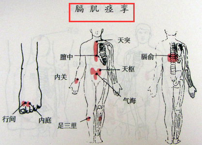 膈肌痉挛