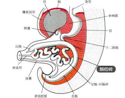 肠扭转