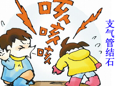 支气管结石