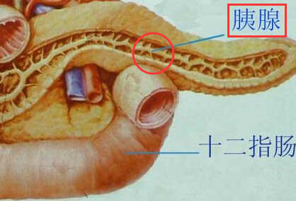 胰腺癌