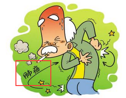 肺癌