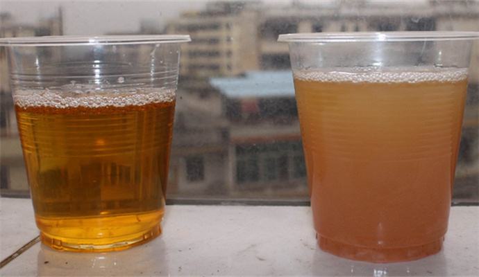 尿液