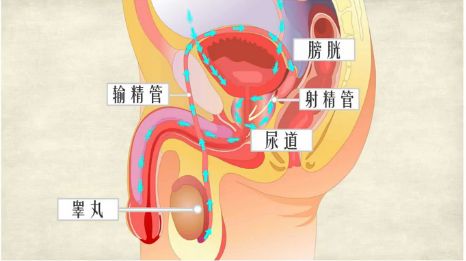 膀胱炎