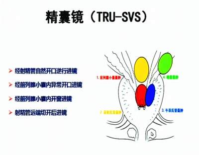 精囊炎