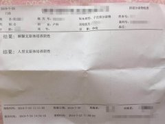 白带多，肚子痛，四个半疗程治疗五年多支原体