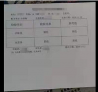 尿刺痛，四年多的支原体感染三个疗程得到有效治疗
