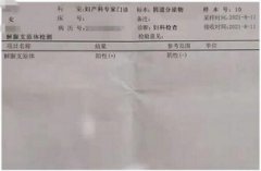 经量大，白带多，一个疗程治疗解脲支原体感染