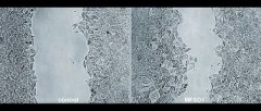 研究发现抑制癌细胞转移的蛋白质