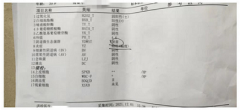 一个疗程治疗二十多年的支原体感染